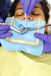 Eyector semi recto de acero (asistente - endodoncia)